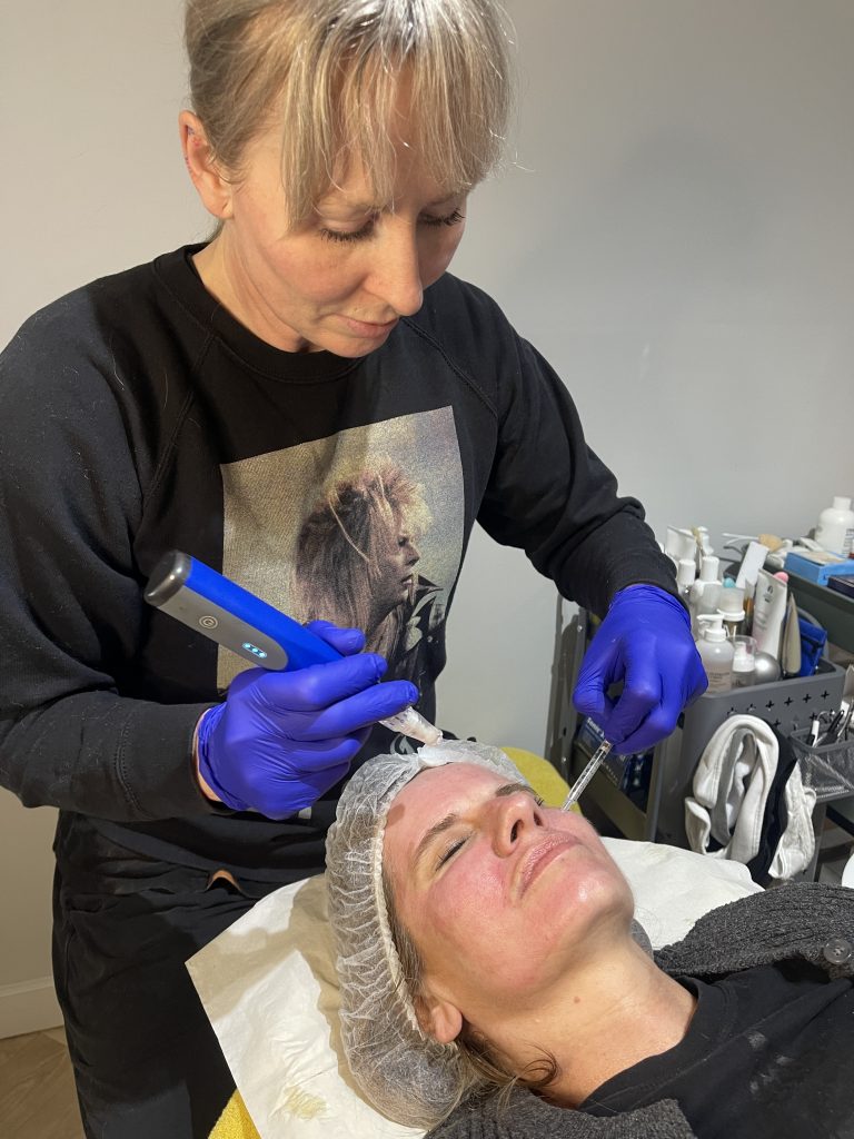 Dr Susan Hunter - SkinPen
